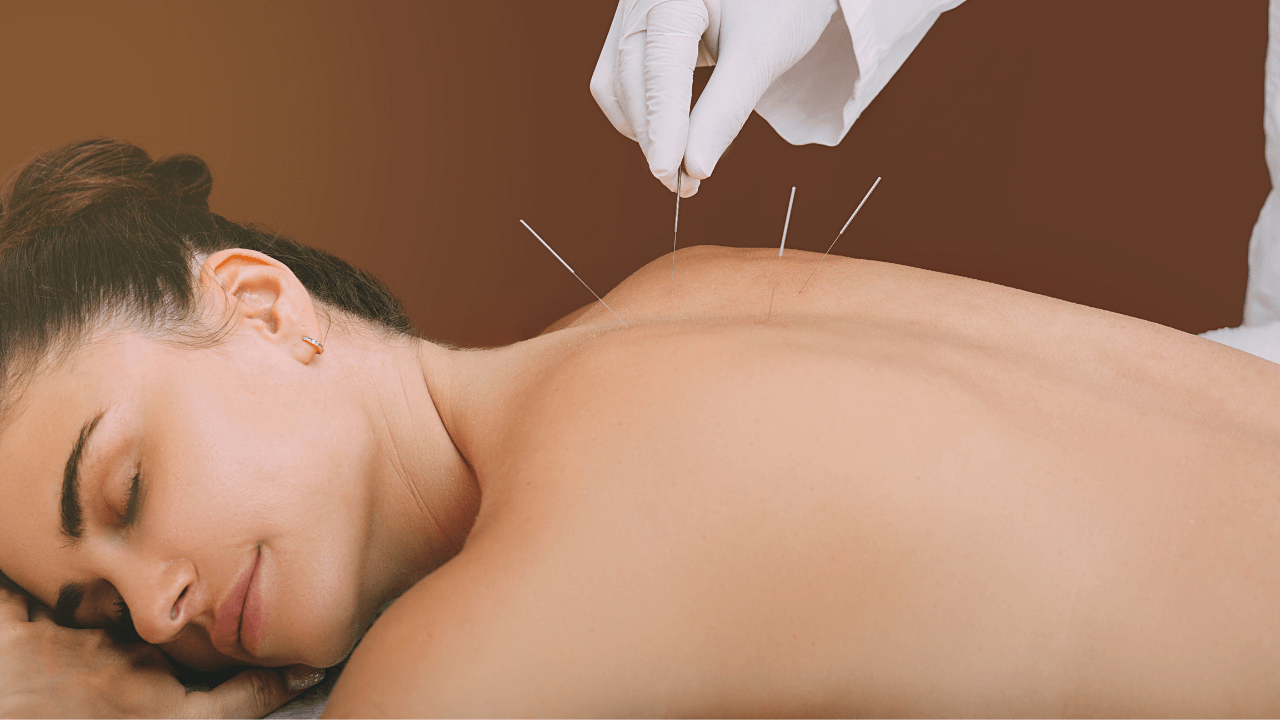 Dry needling