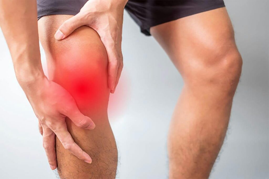 Patellar Tendonitis