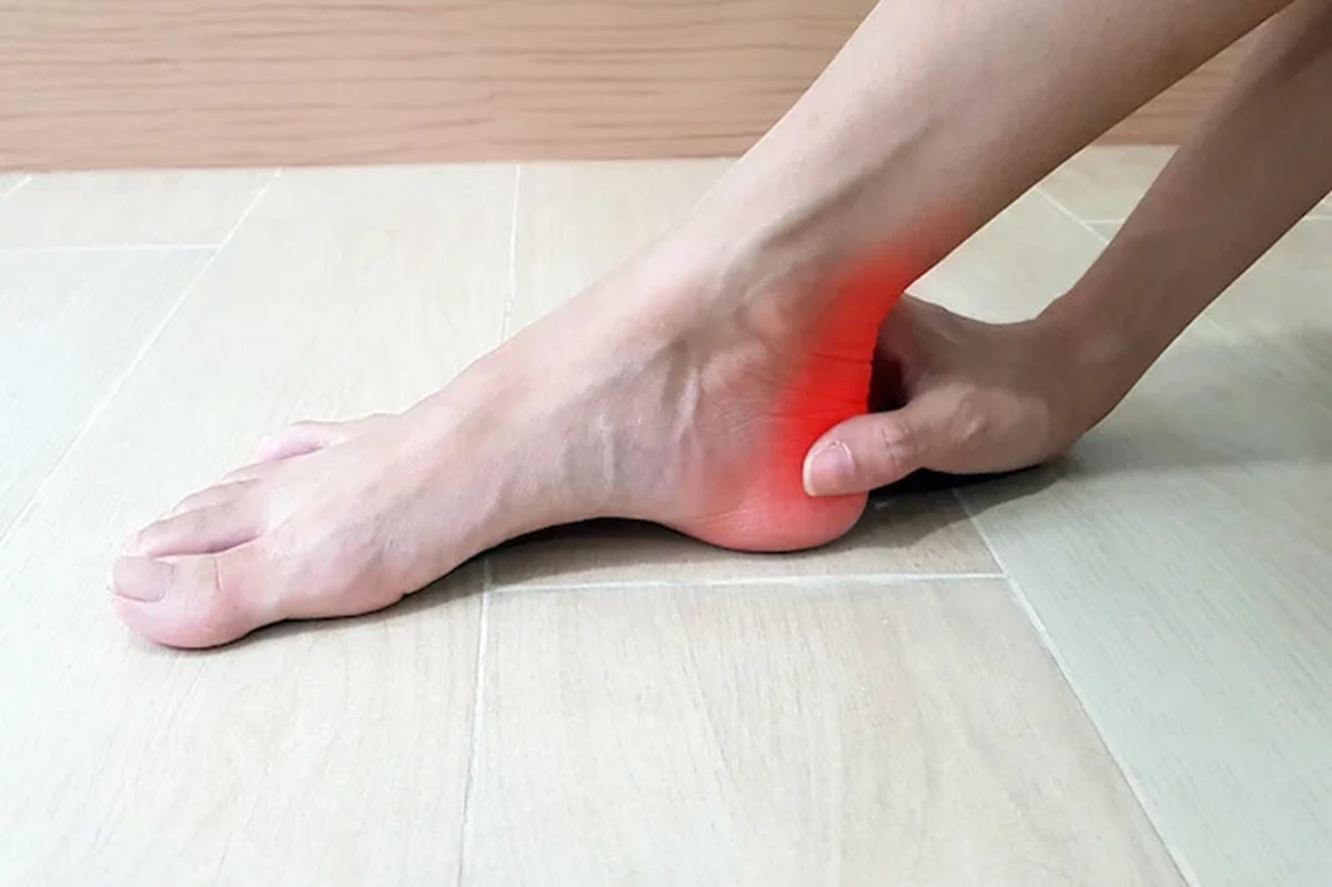How Long Does Achilles Tendonitis Last and How to Recover