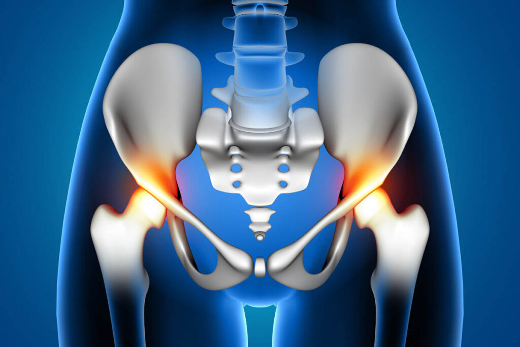 Recognizing Torn Hip Labrum Symptoms and What to Do Next
