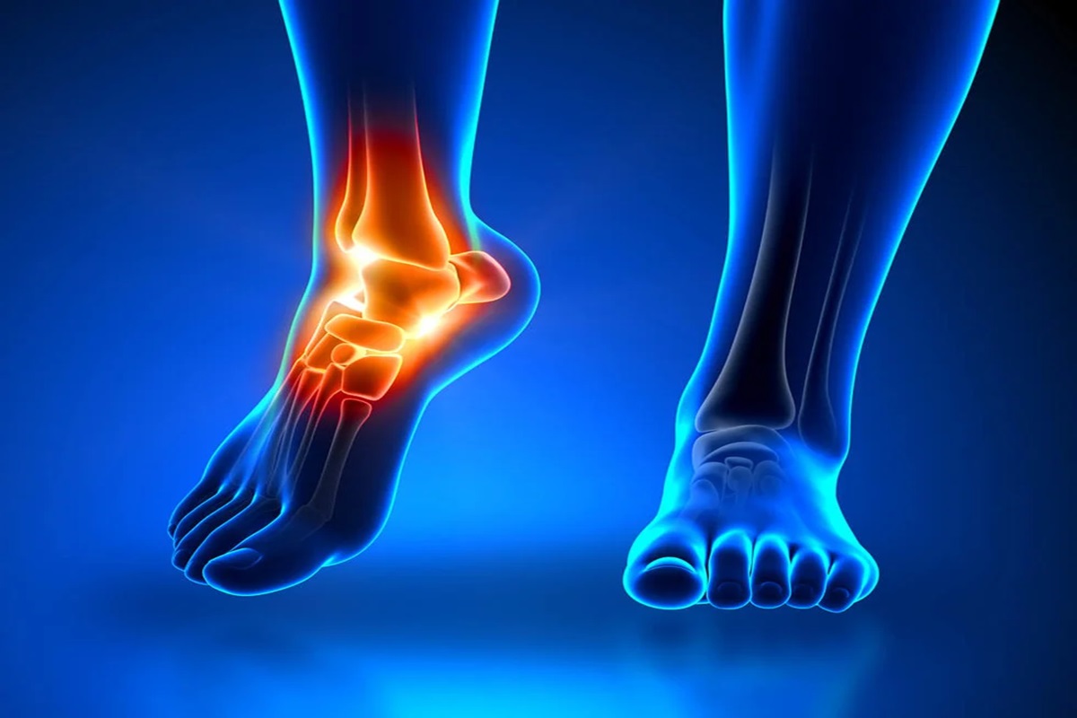 At‑Home First Steps After Injury